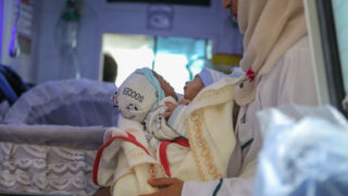 Naděje pro siamská dvojčata v Jemenu